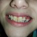 G before