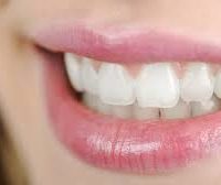 Transparent teeth