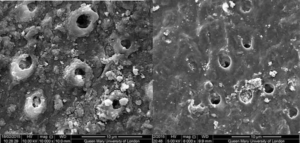 BioMin Fixing cause of sensitivity BioMin Sealing the tubule fix sensitivity