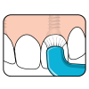 TePe tuft hard to reach : Implants : Braces : Dentures - Image 7