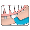 TePe tuft hard to reach : Implants : Braces : Dentures - Image 6