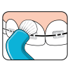 TePe tuft hard to reach : Implants : Braces : Dentures - Image 5